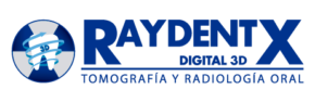 Raydentx